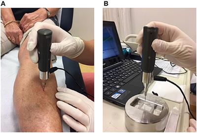 Added Value of Impact Microindentation in the Evaluation of Bone Fragility: A Systematic Review of the Literature